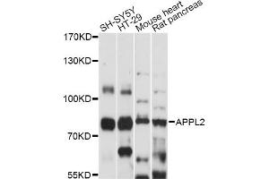Western blot analysis of extracts of various cell lines, using APPL2 antibody (ABIN6292794) at 1:1000 dilution.