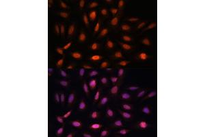 Immunofluorescence analysis of U-2 OS cells using PPIL4 antibody (ABIN7269212) at dilution of 1:100. (PPIL4 anticorps  (AA 301-492))