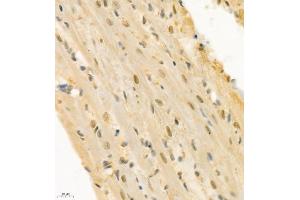 Immunohistochemistry of paraffin embedded rat heart using ZNF106 (ABIN7076260) at dilution of 1:300 (400x lens)