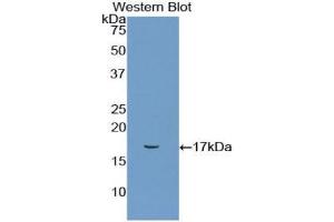Western blot analysis of the recombinant protein. (CD72 anticorps  (AA 126-237))