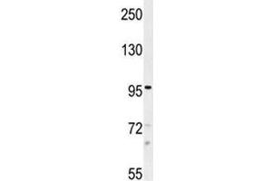 TRPM8 antibody western blot analysis in NCI-H460 lysate.