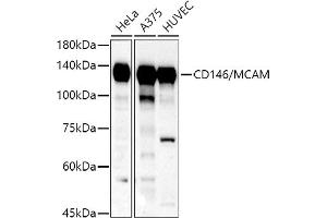 Western blot analysis of extracts of various cell lines, using CD146/MCAM antibody (ABIN6127568, ABIN6143621, ABIN6143622 and ABIN6218100) at 1:500 dilution. (MCAM anticorps  (AA 447-646))