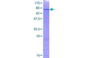 Image no. 1 for Phosphoribosyl Pyrophosphate Amidotransferase (PPAT) (AA 1-517) protein (GST tag) (ABIN1315843)