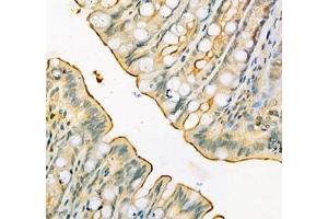Immunohistochemistry of paraffin embedded rat colon using SLC6A19 (ABIN7075682) at dilution of 1:900 (400x lens)