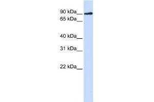 WB Suggested Anti-DCLRE1C Antibody Titration:  0. (DCLRE1C anticorps  (N-Term))