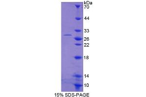 SDS-PAGE analysis of Human ACAA1 Protein.
