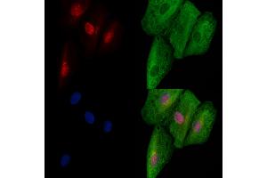 ABIN6257152 and ABIN6273721 staining  cells by IF/ICC.