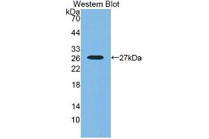 Western blot analysis of the recombinant protein. (SNX18 anticorps  (AA 411-614))