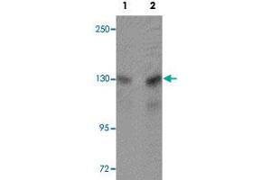 Western blot analysis of A-20 cells with MTUS2 polyclonal antibody  at (Lane 1) 0. (CAZIP anticorps  (C-Term))