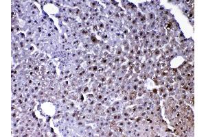 IHC analysis of PARK7 / DJ1 using anti-PARK7 / DJ1 antibody .