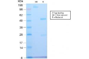 SDS-PAGE Analysis Purified ATRX Rabbit Recombinant Monoclonal Antibody (ATRX/2900R). (Recombinant ATRX anticorps)