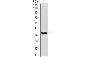 Western blot analysis using ITGA2B mAb against human ITGA2B recombinant protein. (Integrin Alpha2b anticorps  (AA 45-149))