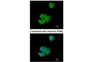 ICC/IF Image Immunofluorescence analysis of methanol-fixed A549, using AGR3, antibody at 1:200 dilution. (AGR3 anticorps  (Center))