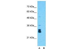 Host:  Rabbit  Target Name:  KITLG  Sample Type:  Jurkat  Lane A:  Primary Antibody  Lane B:  Primary Antibody + Blocking Peptide  Primary Antibody Concentration:  1ug/ml  Peptide Concentration:  5ug/ml  Lysate Quantity:  25ug/lane/lane  Gel Concentration:  0.