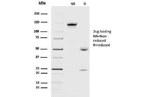 SDS-PAGE Analysis Purified Crystallin Alpha B Mouse Monoclonal Antibody (CPTC-CYRAB-1).