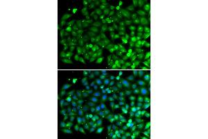 Immunofluorescence analysis of A549 cells using SH3GLB1 antibody (ABIN5974271). (SH3GLB1 anticorps)