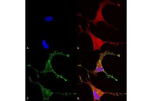 Immunocytochemistry/Immunofluorescence analysis using Mouse Anti-Cav beta 2 Monoclonal Antibody, Clone S8B-1 (ABIN2485039).