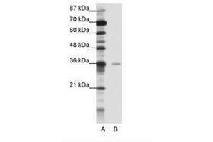 Image no. 1 for anti-Methyl-CpG Binding Domain Protein 2 (MBD2) (AA 151-200) antibody (ABIN202197) (MBD2 anticorps  (AA 151-200))