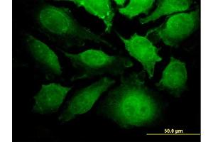 Immunofluorescence of monoclonal antibody to TRIP6 on HeLa cell. (TRIP6 anticorps  (AA 51-148))