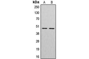 Western blot analysis of Cathepsin E expression in HepG2 (A), HuvEc (B) whole cell lysates.