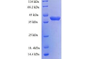 SDS-PAGE (SDS) image for G Antigen 5 (GAGE5) (AA 1-117), (full length) protein (GST tag) (ABIN5709551) (G Antigen 5 Protein (GAGE5) (AA 1-117, full length) (GST tag))