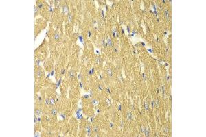 Immunohistochemistry (IHC) image for anti-Tropomyosin 3 (TPM3) (AA 1-284) antibody (ABIN3021721)