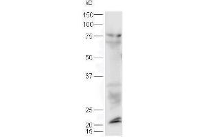 Lane 1: mouse lung probed with Rabbit Anti-Sclerostin Polyclonal Antibody, Unconjugated  at 1:5000 for 90 min at 37˚C. (Sclerostin anticorps  (AA 121-180))