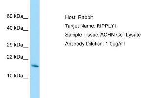 Host: Rabbit Target Name: RIPPLY1 Sample Tissue: Human ACHN Whole Cell Antibody Dilution: 1ug/ml (RIPPLY1 anticorps  (Middle Region))