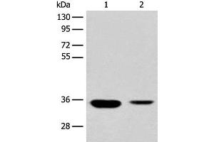 Western blot analysis of Mouse liver tissue and Human fetal liver tissue lysates using RGN Polyclonal Antibody at dilution of 1:500