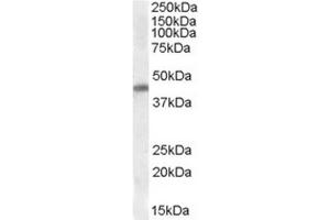 Anti-CSX1 (0. (NK2 Homeobox 5 anticorps  (Internal Region))
