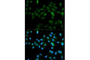 Immunofluorescence analysis of MCF-7 cells using CYP11A1 antibody (ABIN5970856). (CYP11A1 anticorps)