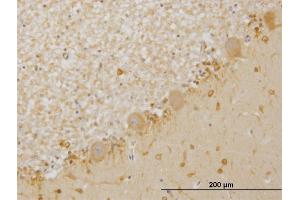 Immunoperoxidase of monoclonal antibody to LIMK1 on formalin-fixed paraffin-embedded human cerebellum.