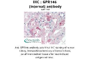 Image no. 3 for anti-G Protein-Coupled Receptor 146 (GPR146) (Internal Region) antibody (ABIN1734950) (GPR146 anticorps  (Internal Region))