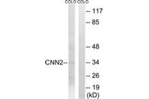 Western blot analysis of extracts from COLO cells, using CNN2 Antibody. (CNN2 anticorps  (AA 121-170))