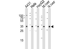 Western blot analysis of lysates from A431, Hela, HepG2 cell line , mouse liver and rat liver tissue lysate(from left to right), using CYB5R3 Antibody (Center) (ABIN6242253 and ABIN6577413).