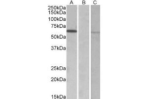 HEK293 lysate (10ug protein in RIPA buffer) over expressing Human MKRN1 with DYKDDDDK tag probed with ABIN2563878 (0. (MKRN1 anticorps  (AA 105-118))