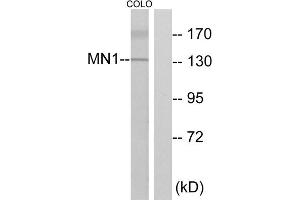 Western blot analysis of extracts from COLO cells, using MN1 antibody. (Meningioma 1 anticorps  (Internal Region))