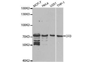 Western blot analysis of extracts of various cell lines, using CFB antibody. (Complement Factor B anticorps  (AA 80-420))