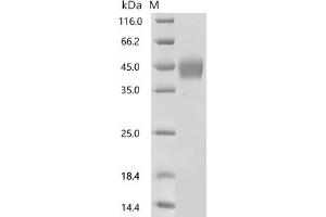Transforming Growth Factor, beta 1 (TGFB1) (AA 30-278) protein (His-Myc tag)