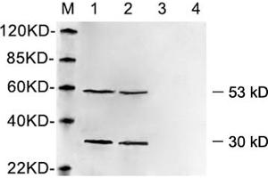 Western blot analysis of cell lysates using 1 µg/mL Rabbit Anti-Vimentin Polyclonal Antibody (ABIN398721) Lane 1, 3: Hela cell lysateLane 2, 4: HEK293 cell lysate Primary antibody: Lane 1, 2: Rabbit Anti-Vimentin Polyclonal AntibodyLane 3, 4: Rabbit Anti-Vimentin Polyclonal Antibody pre-incubated with immunizing peptideThe signal was developed with IRDyeTM 800 Conjugated Goat Anti-Rabbit IgG. (Vimentin anticorps  (AA 400-500))