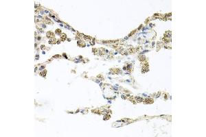 Immunohistochemistry of paraffin-embedded human lung using PIK3CB antibody (ABIN5970370) at dilution of 1/100 (40x lens). (PIK3CB anticorps)