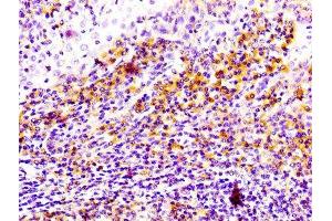 IHC image of ABIN7127284 diluted at 1:100 and staining in paraffin-embedded human tonsil tissue performed on a Leica BondTM system.