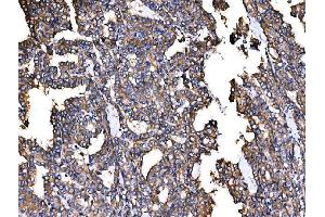 IHC analysis of IRBIT/AHCYL1 using anti-IRBIT/AHCYL1 antibody (ABIN7600030). (AHCYL1 anticorps  (AA 14-57))