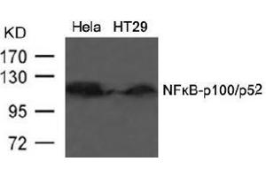 Image no. 3 for anti-Nuclear Factor of kappa Light Polypeptide Gene Enhancer in B-Cells 2 (NFKB2) (AA 864-868) antibody (ABIN197118) (NFKB2 anticorps  (AA 864-868))