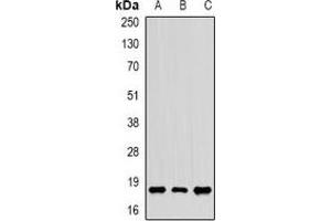 Western blot analysis of CIRBP expression in HL60 (A), SKOV3 (B), mouse brain (C) whole cell lysates. (CIRBP anticorps)
