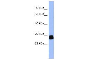 WB Suggested Anti-PDX1  Antibody Titration: 0. (PDX1 anticorps  (N-Term))