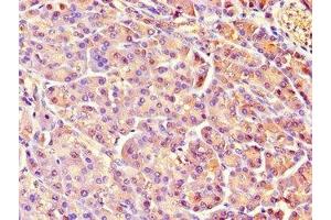 Immunohistochemistry of paraffin-embedded human pancreatic tissue using ABIN7158464 at dilution of 1:100 (REG1A anticorps  (AA 23-166))
