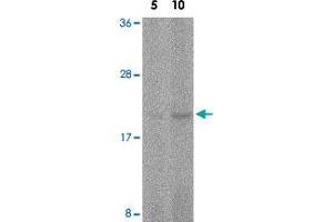 Western blot analysis of FAIM in human spleen tissue lysate with FAIM polyclonal antibody  at 5 and 10 ug/mL . (FAIM anticorps  (C-Term))