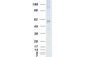 Validation with Western Blot