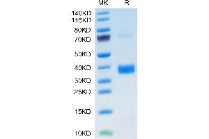 Biotinylated Human Apolipoprotein E on Tris-Bis PAGE under reduced condition. (ApoE3 Protein (AA 19-317) (His tag,Biotin))
